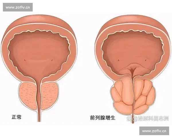 男科健康新趋势:从预防到治疗全面解析男性生殖与泌尿系统疾病的诊疗方法 男科健康新趋势:从预防到治疗全面解析男性生殖与泌尿系统疾病的诊疗方法